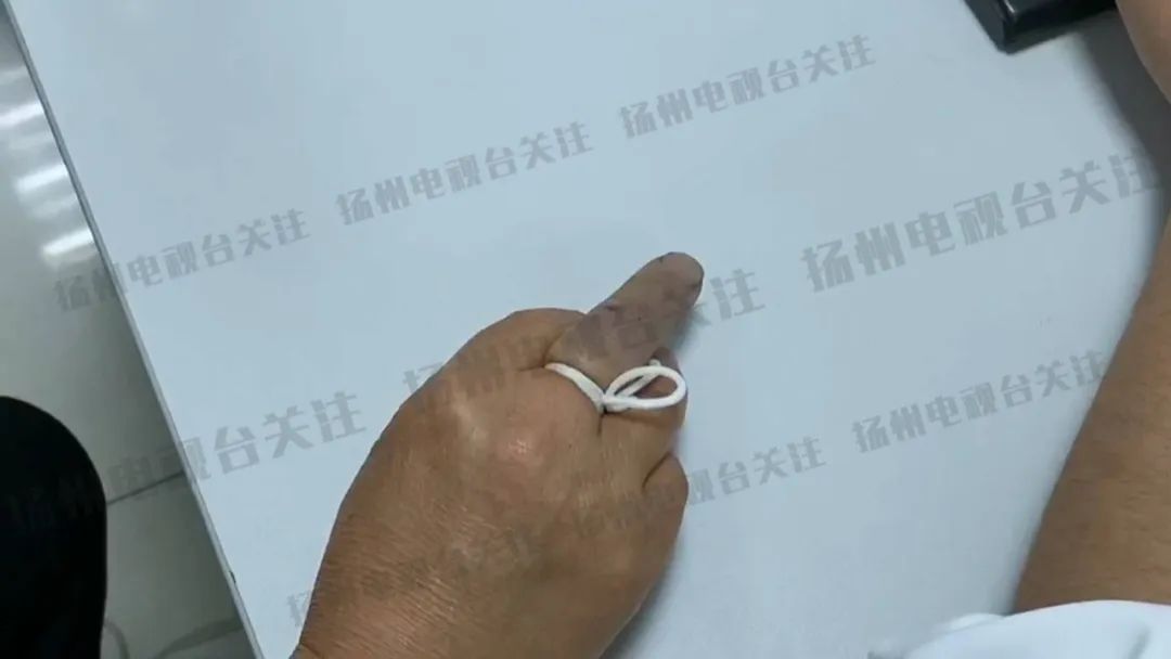 毒蛇咬伤后的自救指南
