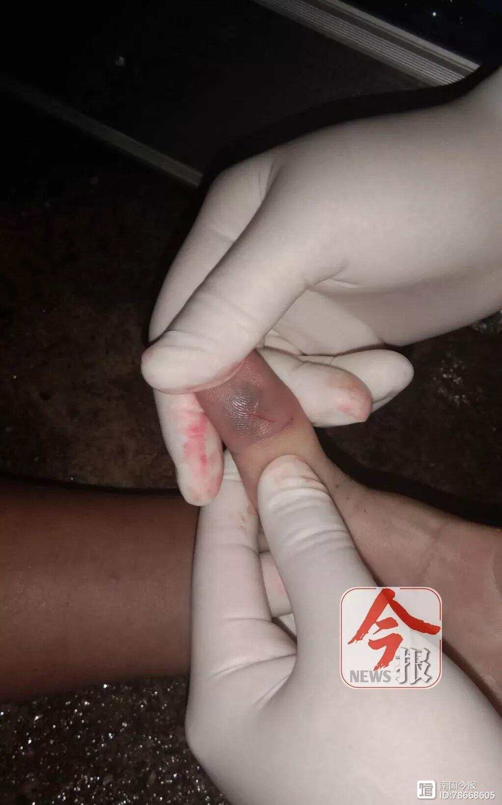 新加坡惊现幼师疑被蛇咬伤身亡事件